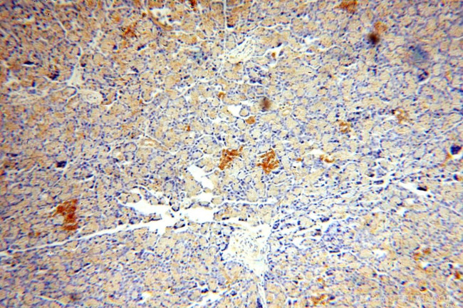 ATP6V1A Antibody in Immunohistochemistry (Paraffin) (IHC (P))