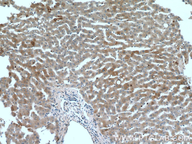 OMA1 Antibody in Immunohistochemistry (Paraffin) (IHC (P))