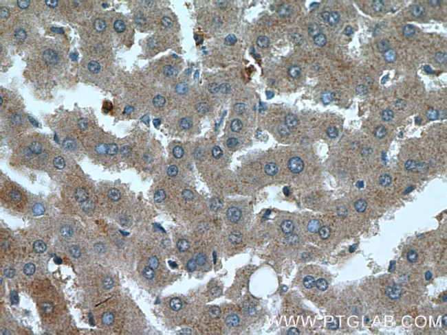 OMA1 Antibody in Immunohistochemistry (Paraffin) (IHC (P))