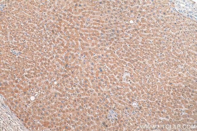 OMA1 Antibody in Immunohistochemistry (Paraffin) (IHC (P))