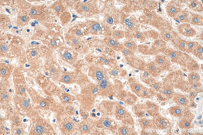 OMA1 Antibody in Immunohistochemistry (Paraffin) (IHC (P))