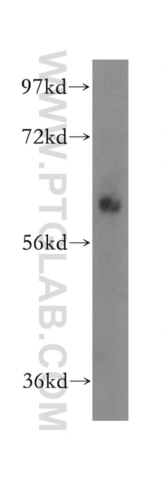 OMA1 Antibody in Western Blot (WB)