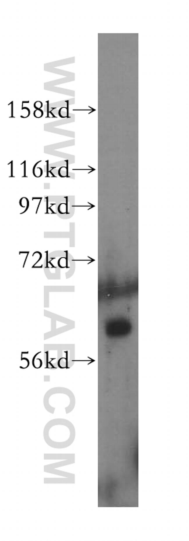 OMA1 Antibody in Western Blot (WB)