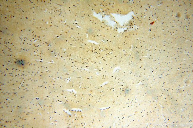 RASGEF1A Antibody in Immunohistochemistry (Paraffin) (IHC (P))