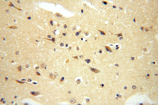 RASGEF1A Antibody in Immunohistochemistry (Paraffin) (IHC (P))