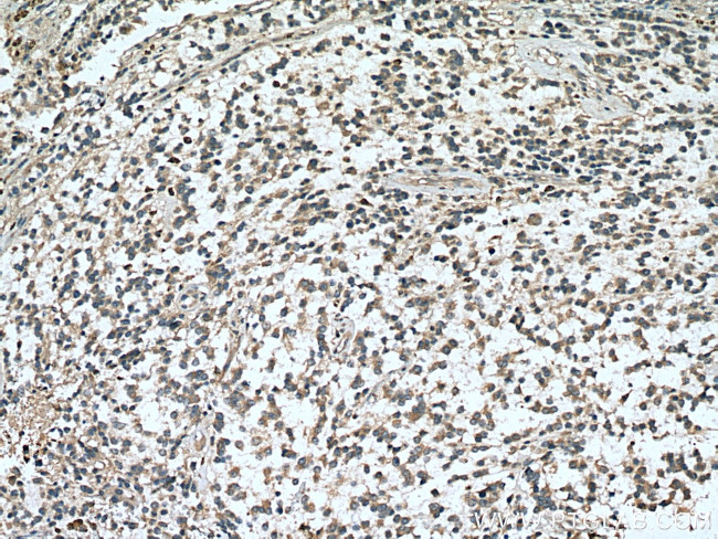 RASGEF1A Antibody in Immunohistochemistry (Paraffin) (IHC (P))