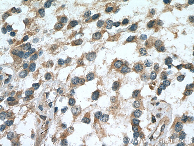 RASGEF1A Antibody in Immunohistochemistry (Paraffin) (IHC (P))