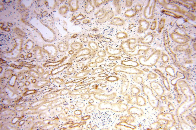 OXCT2 Antibody in Immunohistochemistry (Paraffin) (IHC (P))