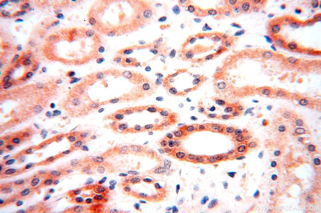 OXCT2 Antibody in Immunohistochemistry (Paraffin) (IHC (P))