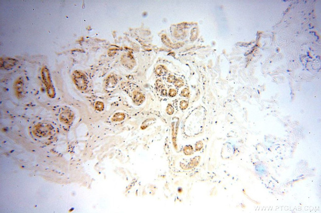 OXCT2 Antibody in Immunohistochemistry (Paraffin) (IHC (P))