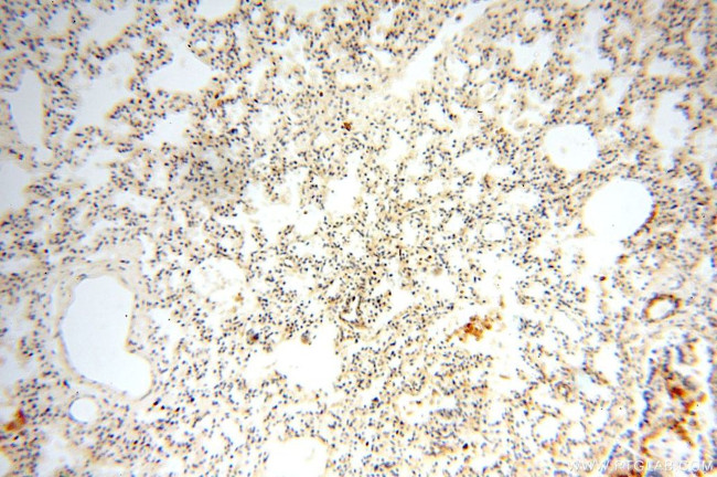 OXCT2 Antibody in Immunohistochemistry (Paraffin) (IHC (P))