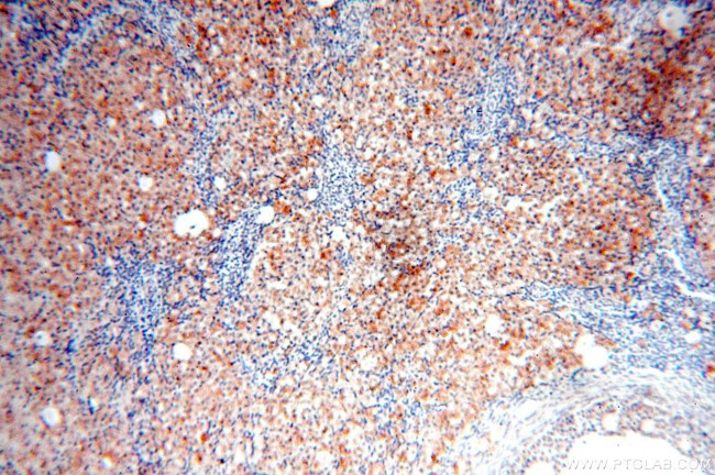 OXCT2 Antibody in Immunohistochemistry (Paraffin) (IHC (P))