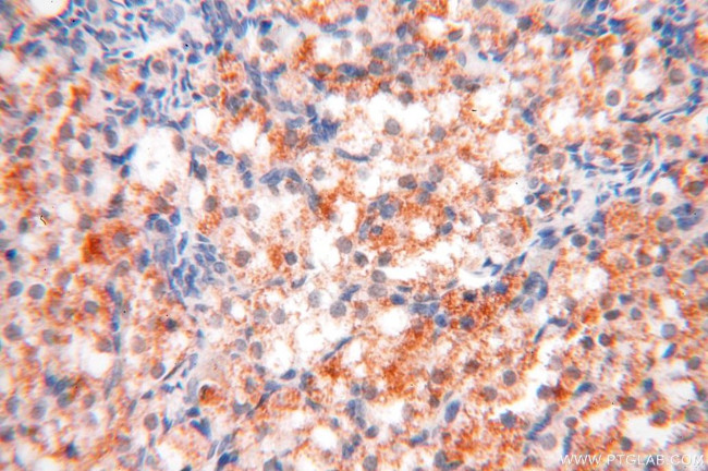 OXCT2 Antibody in Immunohistochemistry (Paraffin) (IHC (P))