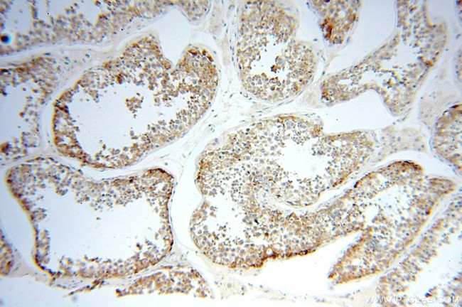 OXCT2 Antibody in Immunohistochemistry (Paraffin) (IHC (P))