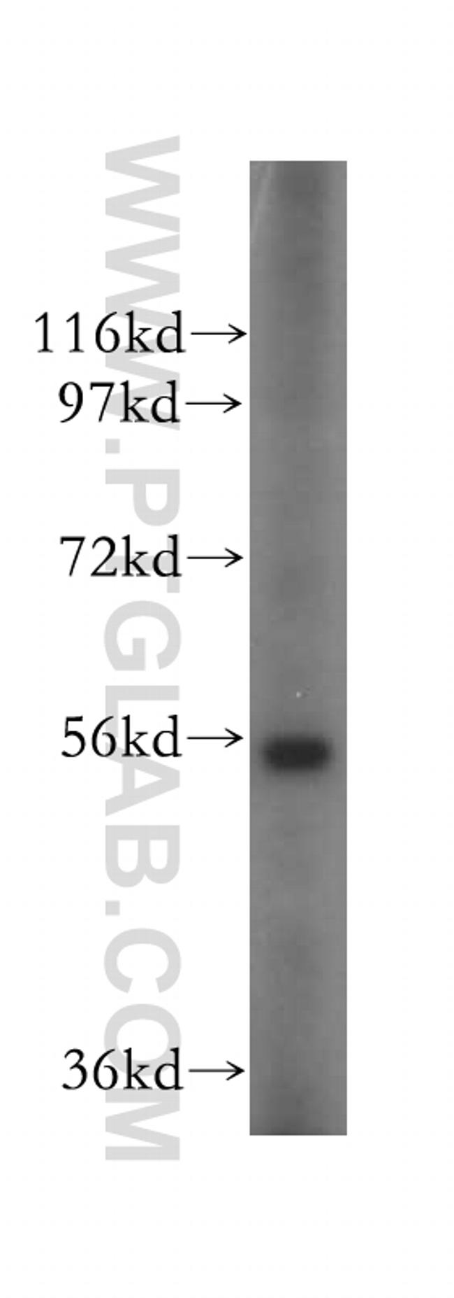 OXCT2 Antibody in Western Blot (WB)