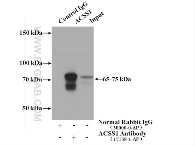 ACSS1 Antibody in Immunoprecipitation (IP)