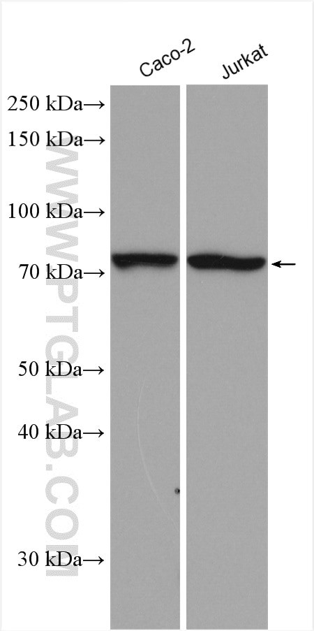 ACSS1 Antibody in Western Blot (WB)