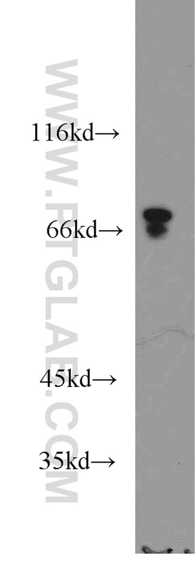 ACSS1 Antibody in Western Blot (WB)