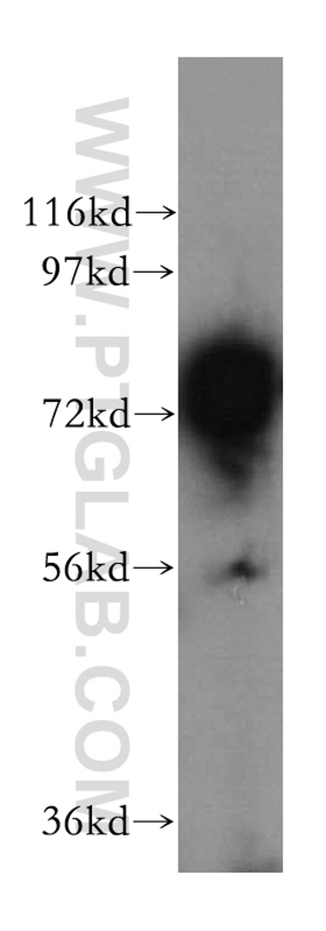 ACSS1 Antibody in Western Blot (WB)