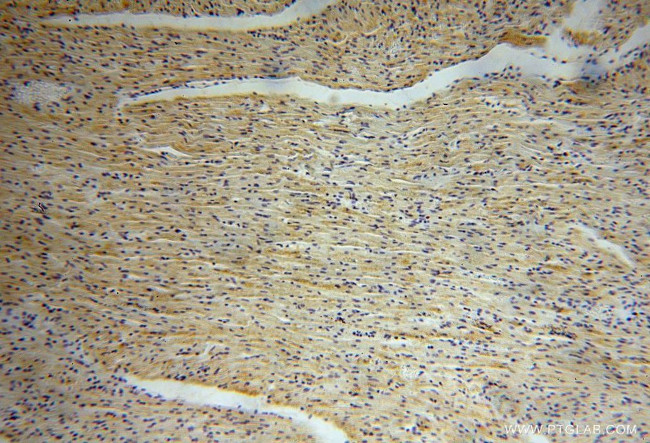 B3GALNT2 Antibody in Immunohistochemistry (Paraffin) (IHC (P))