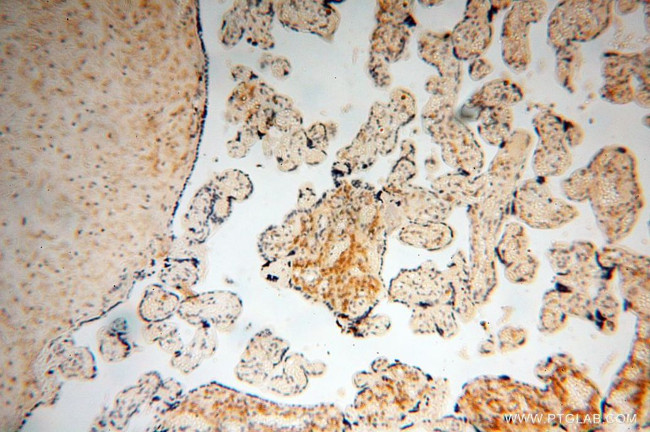 PYCR2 Antibody in Immunohistochemistry (Paraffin) (IHC (P))