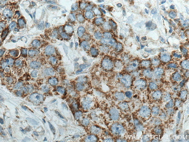 PYCR2 Antibody in Immunohistochemistry (Paraffin) (IHC (P))