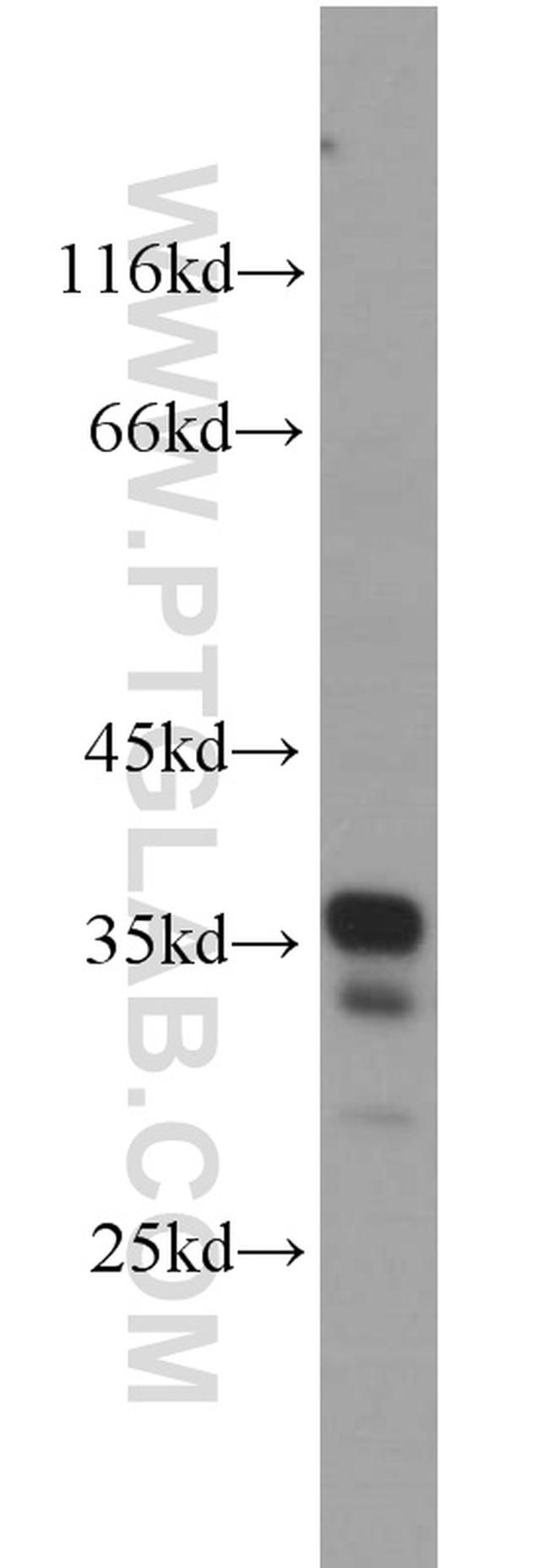 PYCR2 Antibody in Western Blot (WB)