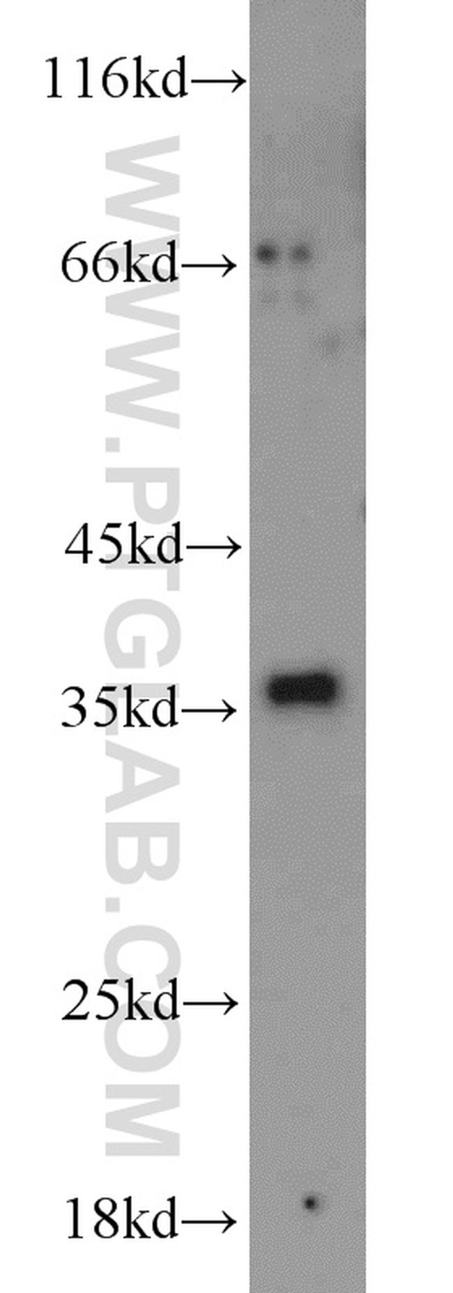 PYCR2 Antibody in Western Blot (WB)