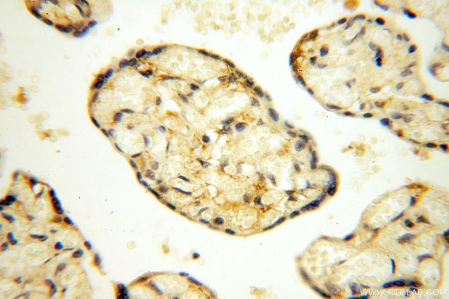 YARS2 Antibody in Immunohistochemistry (Paraffin) (IHC (P))