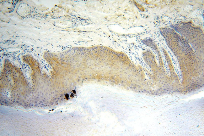 YARS2 Antibody in Immunohistochemistry (Paraffin) (IHC (P))