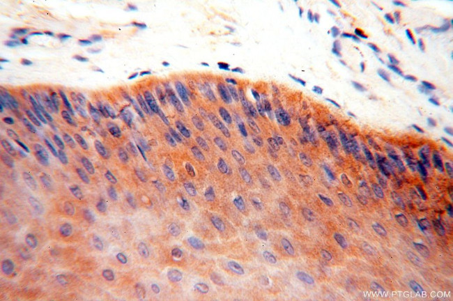 YARS2 Antibody in Immunohistochemistry (Paraffin) (IHC (P))