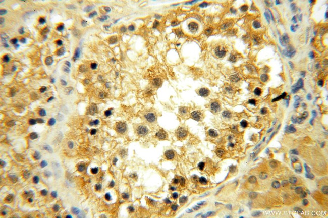 YARS2 Antibody in Immunohistochemistry (Paraffin) (IHC (P))