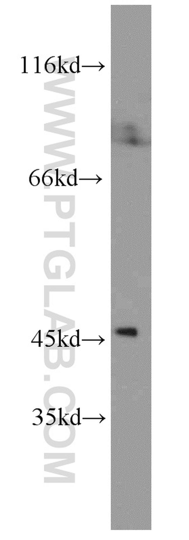 YARS2 Antibody in Western Blot (WB)