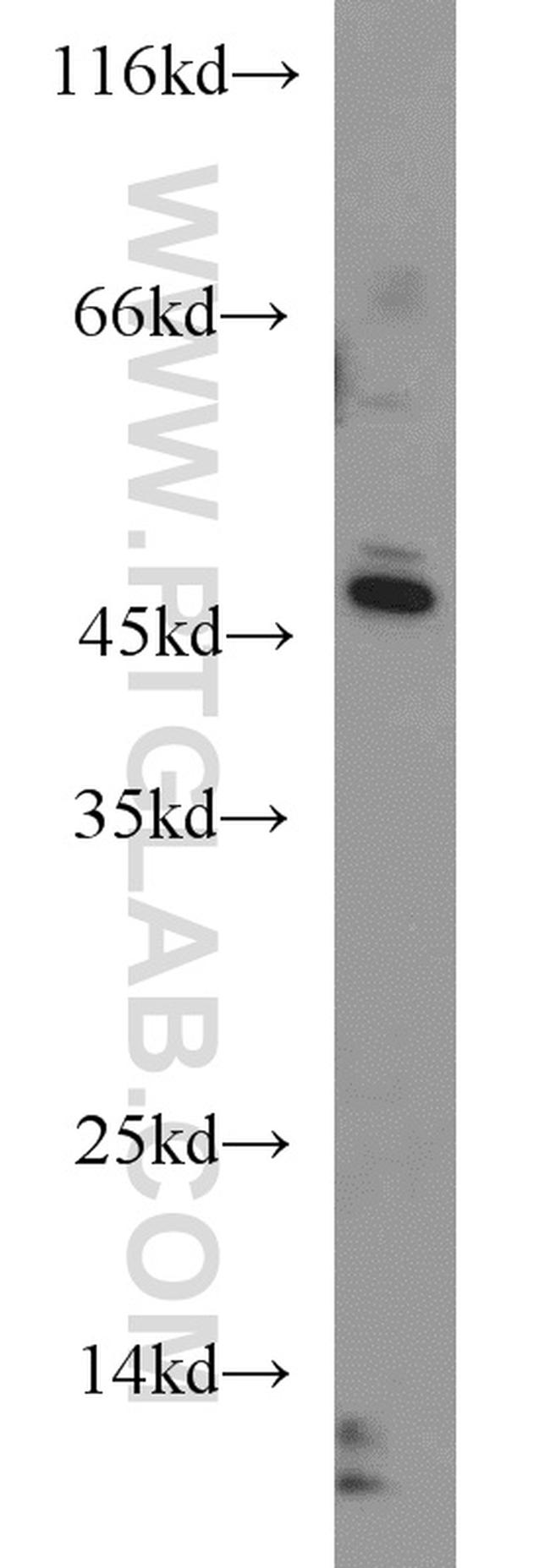 YARS2 Antibody in Western Blot (WB)