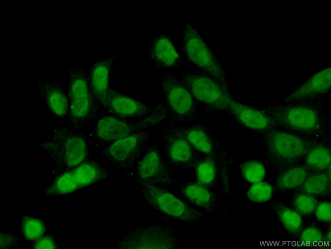 TCEA3 Antibody in Immunocytochemistry (ICC/IF)