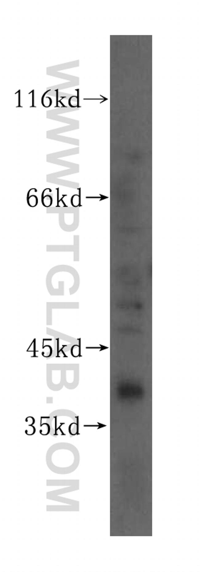 TCEA3 Antibody in Western Blot (WB)