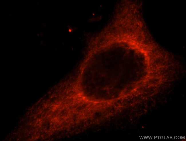 ACAD10 Antibody in Immunocytochemistry (ICC/IF)