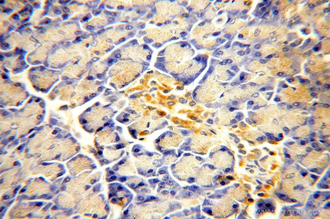 ACAD10 Antibody in Immunohistochemistry (Paraffin) (IHC (P))