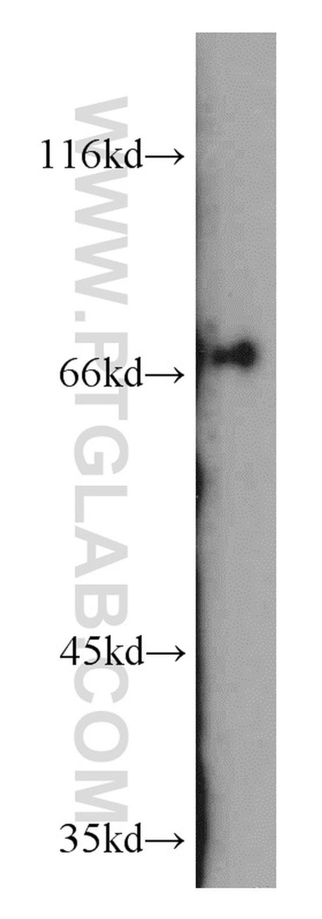 OATP14 Antibody in Western Blot (WB)