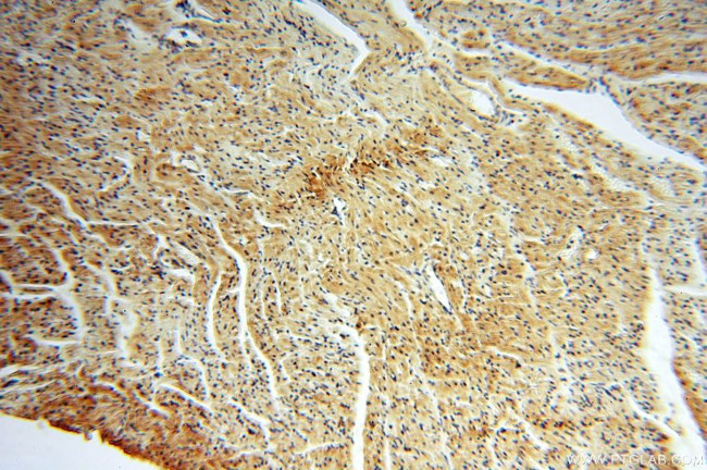 APOBEC4 Antibody in Immunohistochemistry (Paraffin) (IHC (P))