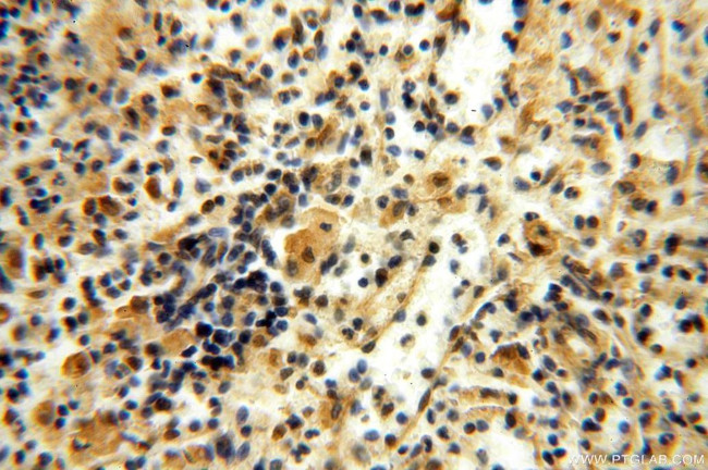 APOBEC4 Antibody in Immunohistochemistry (Paraffin) (IHC (P))