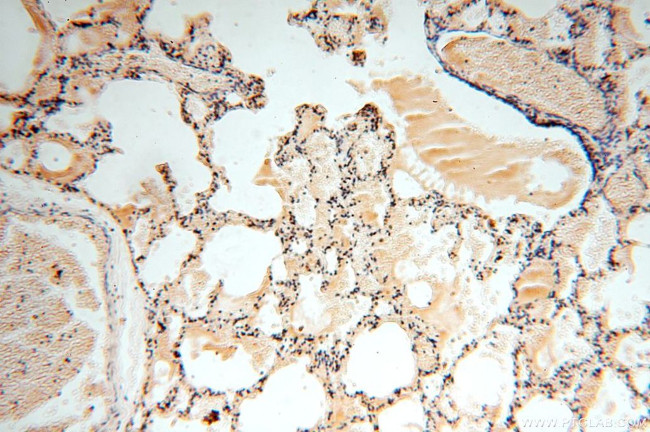 APOBEC4 Antibody in Immunohistochemistry (Paraffin) (IHC (P))