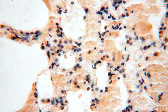 APOBEC4 Antibody in Immunohistochemistry (Paraffin) (IHC (P))