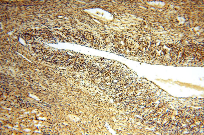 APOBEC4 Antibody in Immunohistochemistry (Paraffin) (IHC (P))