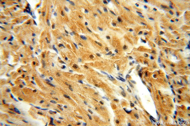 APOBEC4 Antibody in Immunohistochemistry (Paraffin) (IHC (P))