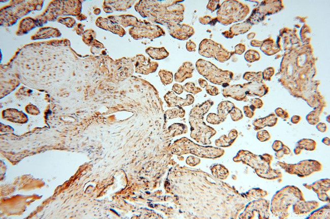 APOBEC4 Antibody in Immunohistochemistry (Paraffin) (IHC (P))