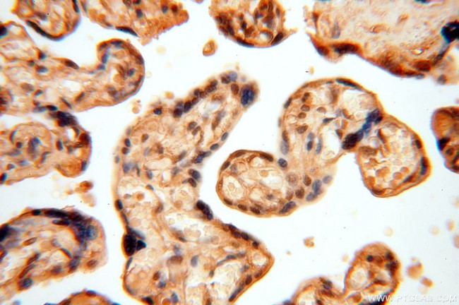 APOBEC4 Antibody in Immunohistochemistry (Paraffin) (IHC (P))