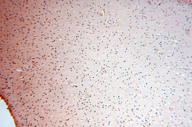 APOBEC4 Antibody in Immunohistochemistry (Paraffin) (IHC (P))