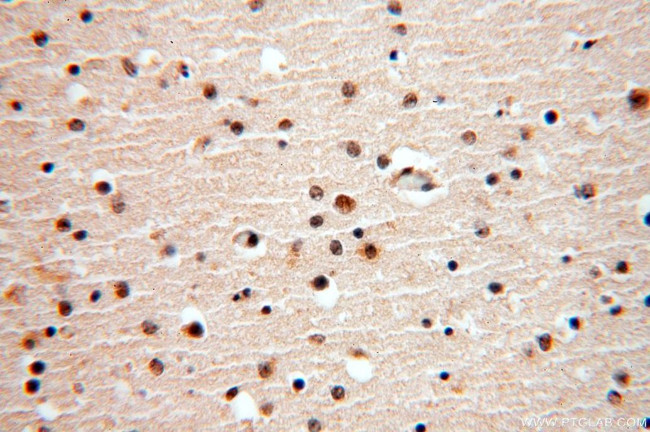 APOBEC4 Antibody in Immunohistochemistry (Paraffin) (IHC (P))