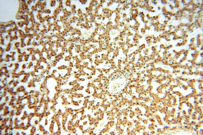 APOBEC4 Antibody in Immunohistochemistry (Paraffin) (IHC (P))